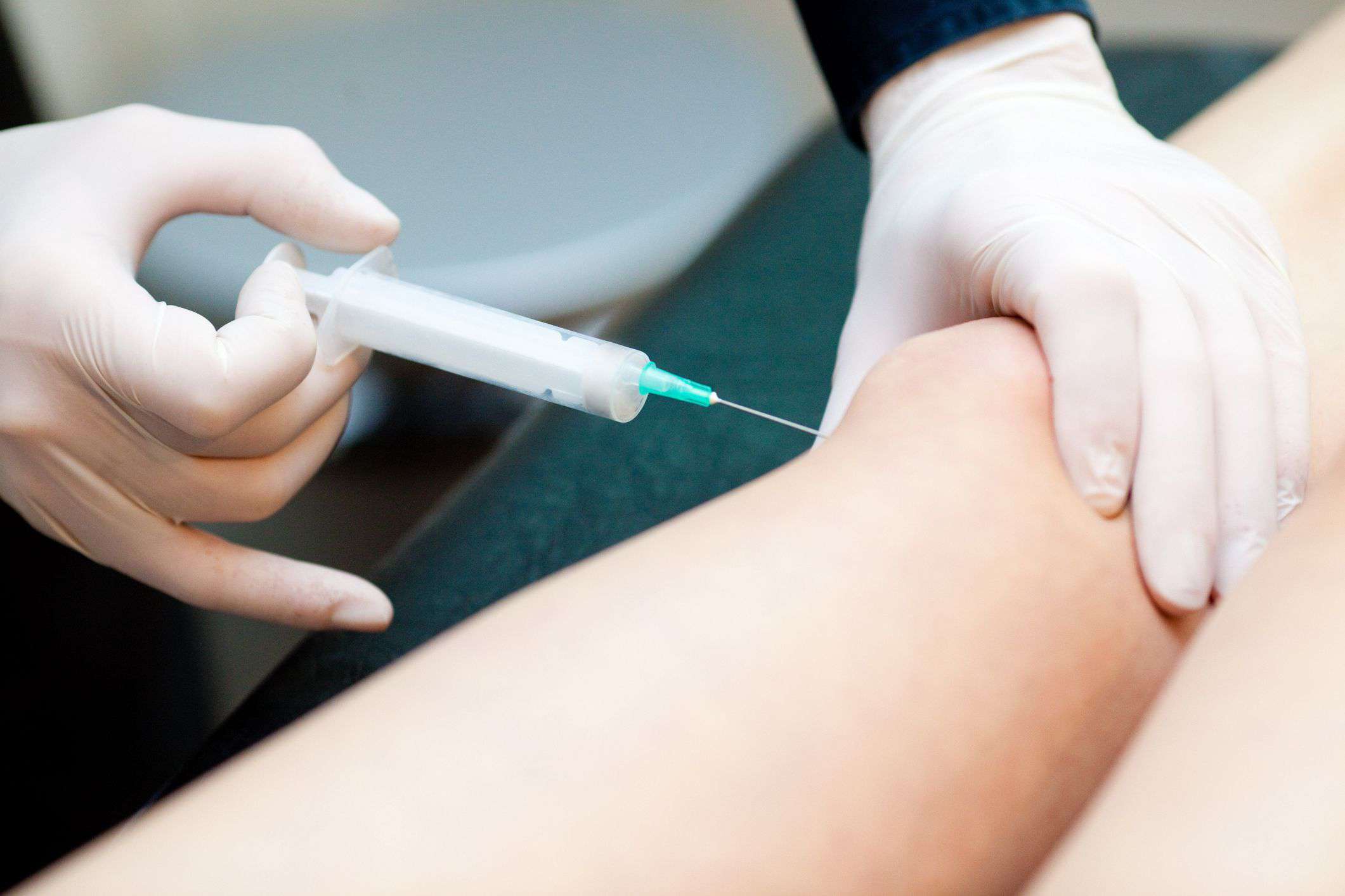Intraarticular Injection